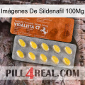 Imágenes De Sildenafil 100Mg 42